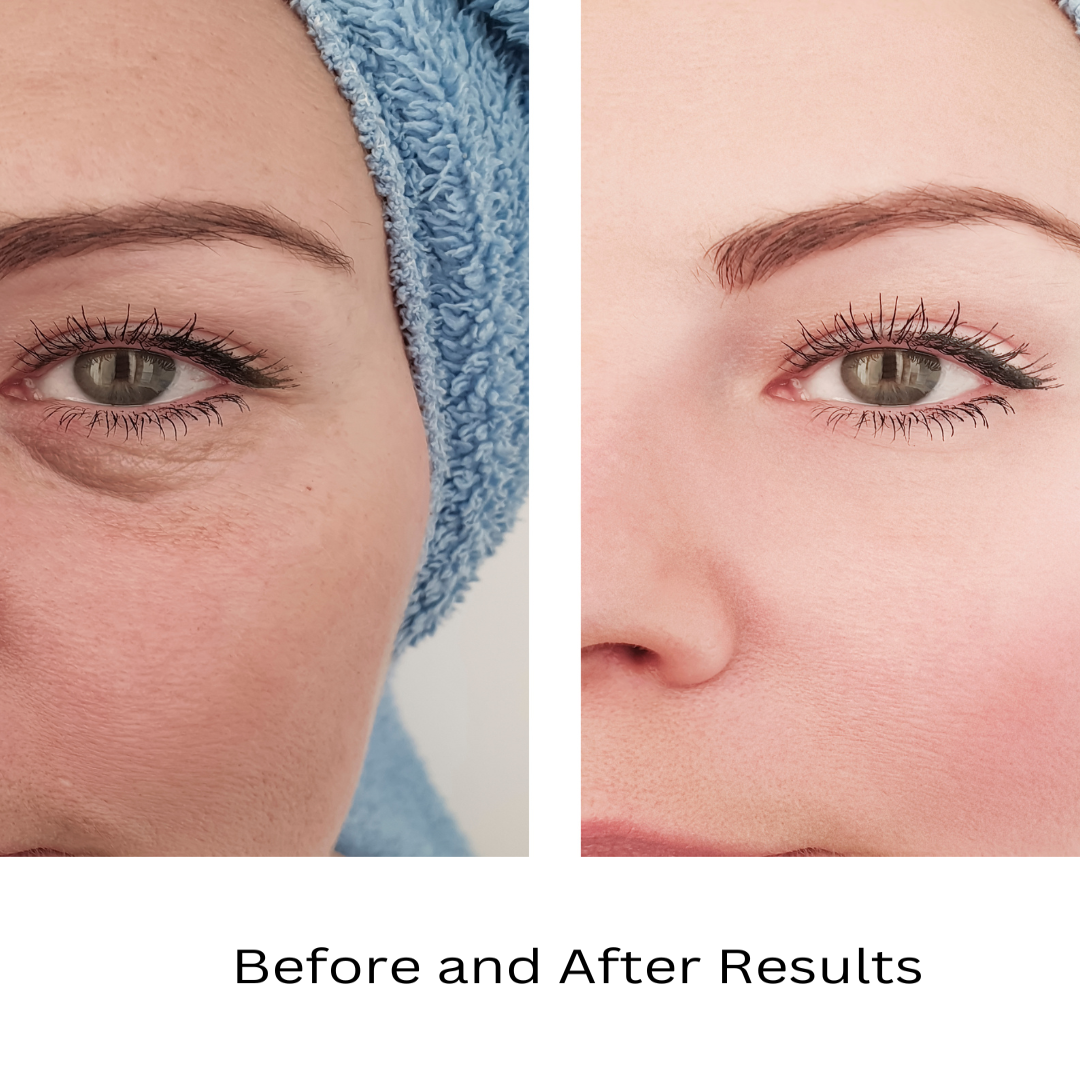 ORGANIC UNDER EYE YOUTH CORRECTOR - For Women-2