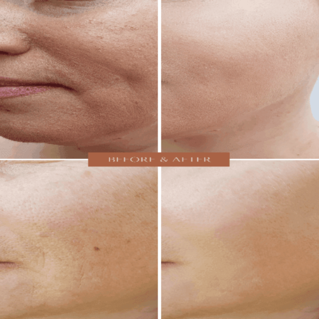 Organic Anti-Aging Facial Moisturizer with Chamomile -  For WOMEN-1