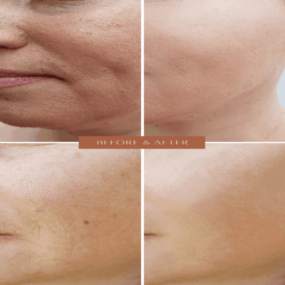 Organic Anti-Aging Facial Moisturizer with Chamomile -  For WOMEN-1