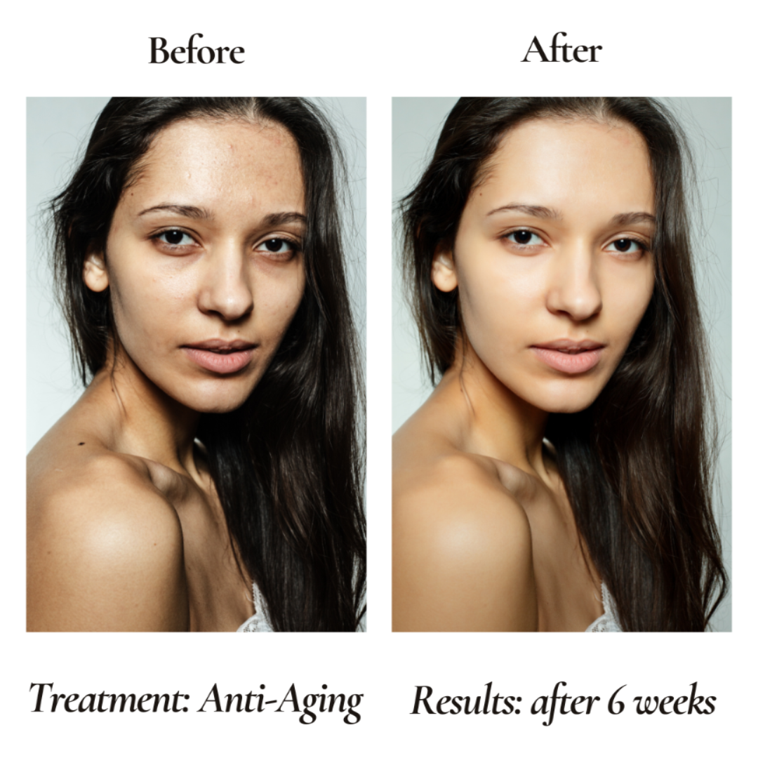 Anti-Aging Organic Facial Moisturizer - FOR WOMEN-1